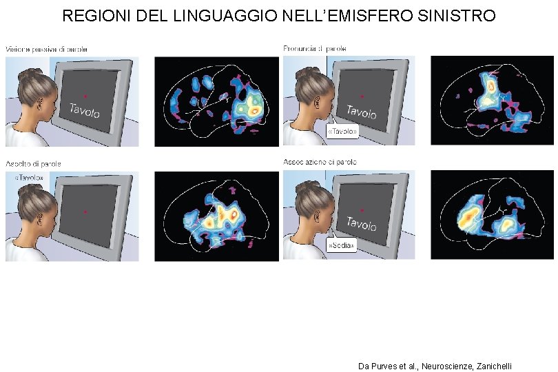 REGIONI DEL LINGUAGGIO NELL’EMISFERO SINISTRO Da Purves et al. , Neuroscienze, Zanichelli REGIONI DEL LINGUAGGIO NELL’EMISFERO SINISTRO Da Purves et al. , Neuroscienze, Zanichelli