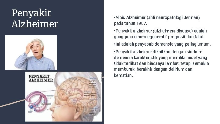 Penyakit Alzheimer • Alois Alzheimer (ahli neuropatologi Jerman) pada tahun 1907. • Penyakit alzheimer