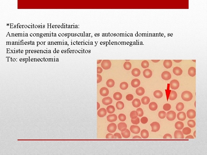 *Esferocitosis Hereditaria: Anemia congenita cospuscular, es autosomica dominante, se manifiesta por anemia, ictericia y *Esferocitosis Hereditaria: Anemia congenita cospuscular, es autosomica dominante, se manifiesta por anemia, ictericia y