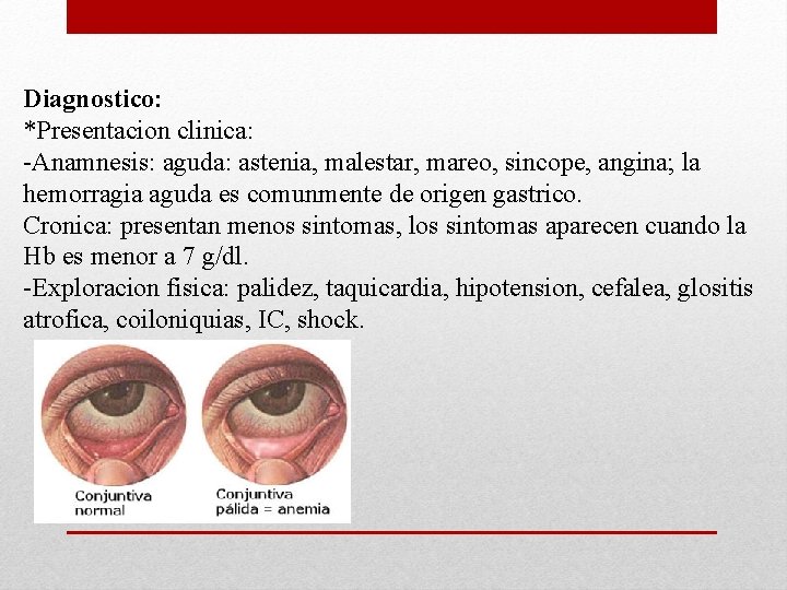 Diagnostico: *Presentacion clinica: -Anamnesis: aguda: astenia, malestar, mareo, sincope, angina; la hemorragia aguda es Diagnostico: *Presentacion clinica: -Anamnesis: aguda: astenia, malestar, mareo, sincope, angina; la hemorragia aguda es