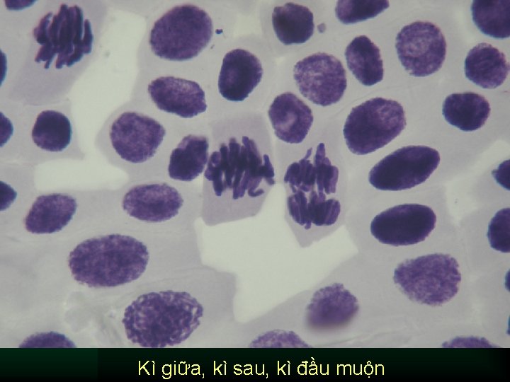 Kì giữa, kì sau, kì đầu muộn 