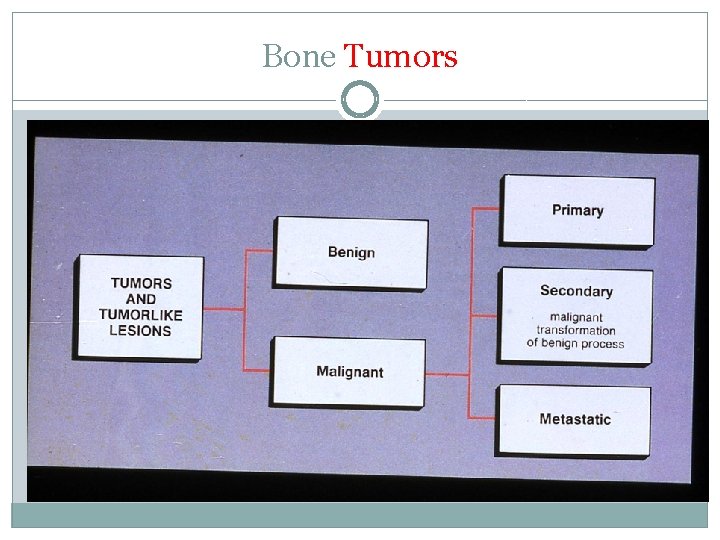 Bone Tumors 
