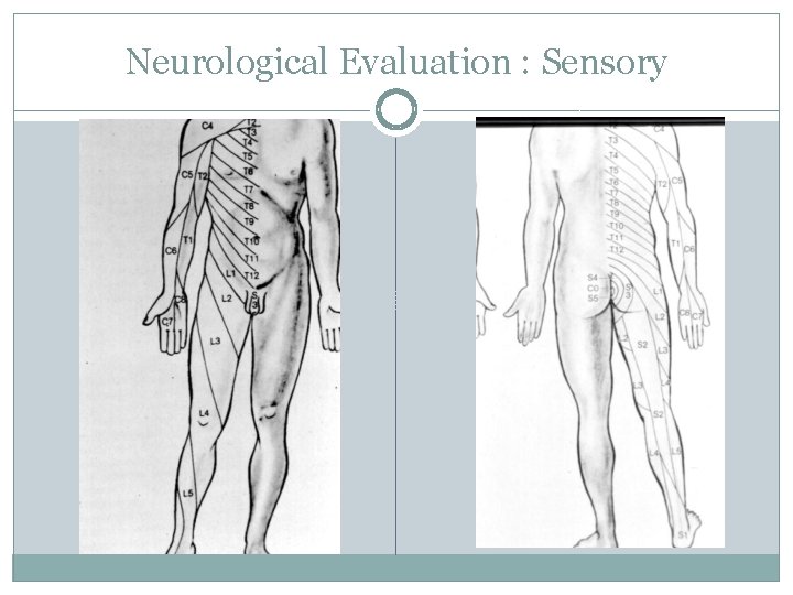 Neurological Evaluation : Sensory 