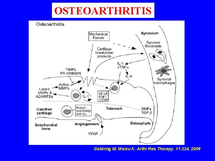 OSTEOARTHRITIS Goldring M, Marcu K. Arthr Res Therapy. 11: 224, 2009 