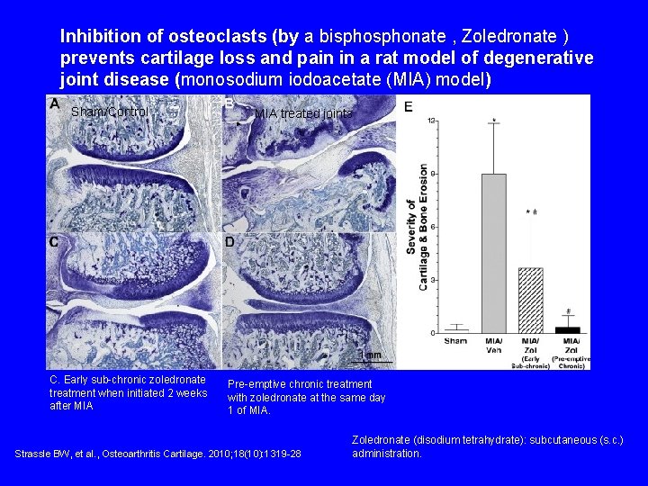 Inhibition of osteoclasts (by a bisphonate , Zoledronate ) prevents cartilage loss and pain