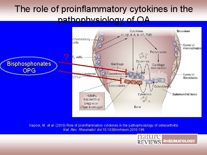 The role of proinflammatory cytokines in the pathophysiology of OA Bisphonates OPG ? Kapoor,