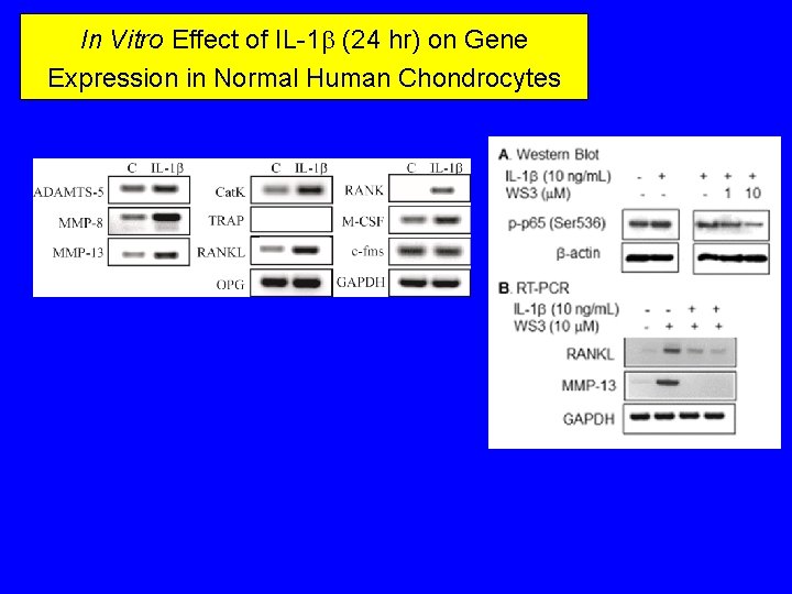 In Vitro Effect of IL-1 b (24 hr) on Gene Expression in Normal Human