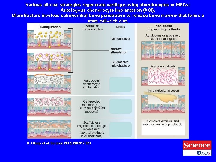 Various clinical strategies regenerate cartilage using chondrocytes or MSCs: Autologous chondrocyte implantation (ACI), Microfracture