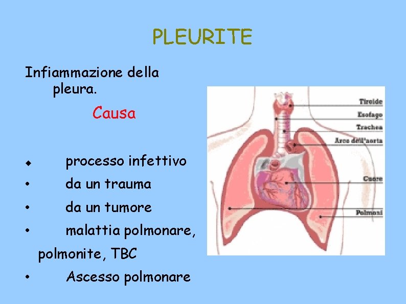 PLEURITE Infiammazione della pleura. Causa processo infettivo • da un trauma • da un