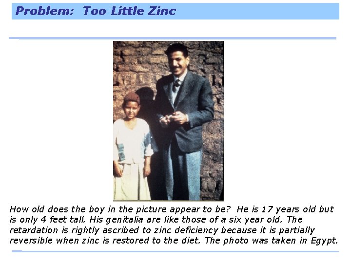 Problem: Too Little Zinc How old does the boy in the picture appear to