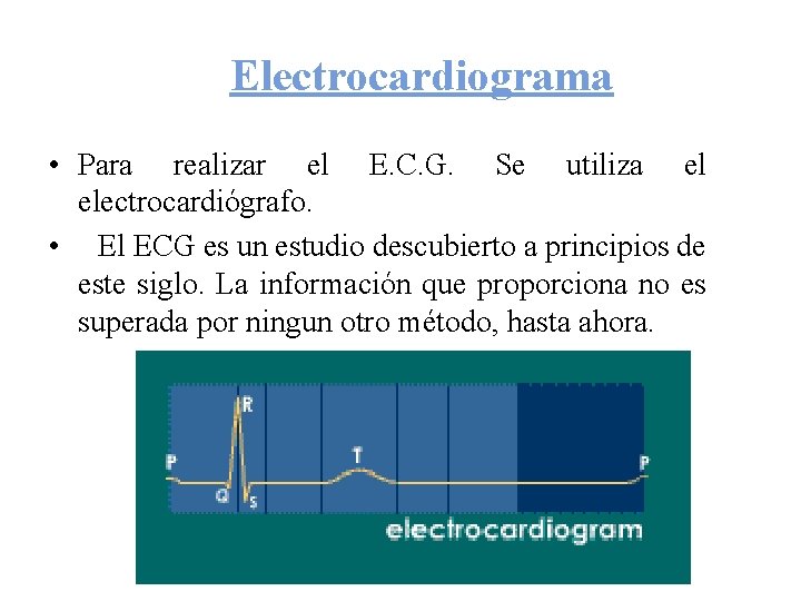 Electrocardiograma • Para realizar el E. C. G. Se utiliza el electrocardiógrafo. • El