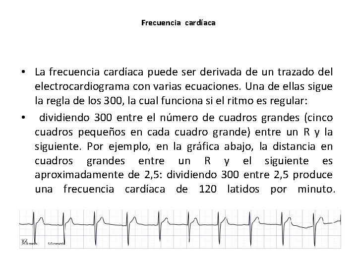 Frecuencia cardíaca • La frecuencia cardíaca puede ser derivada de un trazado del electrocardiograma