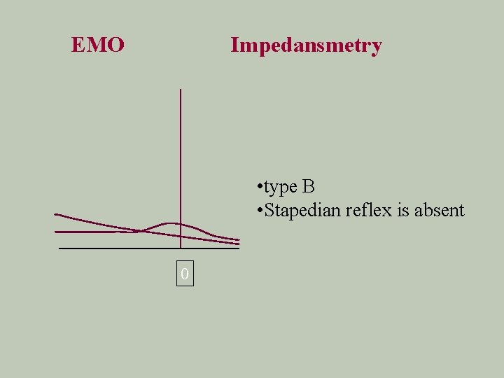 EMO Impedansmetry • type B • Stapedian reflex is absent 0 