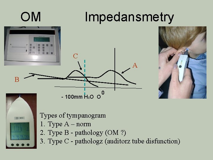 OM Impedansmetry C A B - 100 mm H 2 O O 0 Types