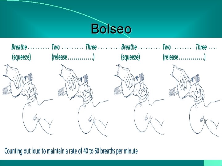 Bolseo 