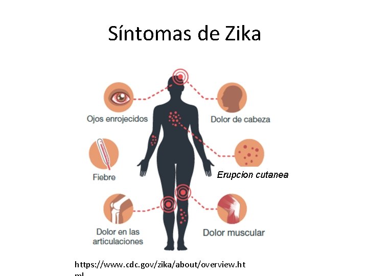 Síntomas de Zika Erupcion cutanea https: //www. cdc. gov/zika/about/overview. ht 