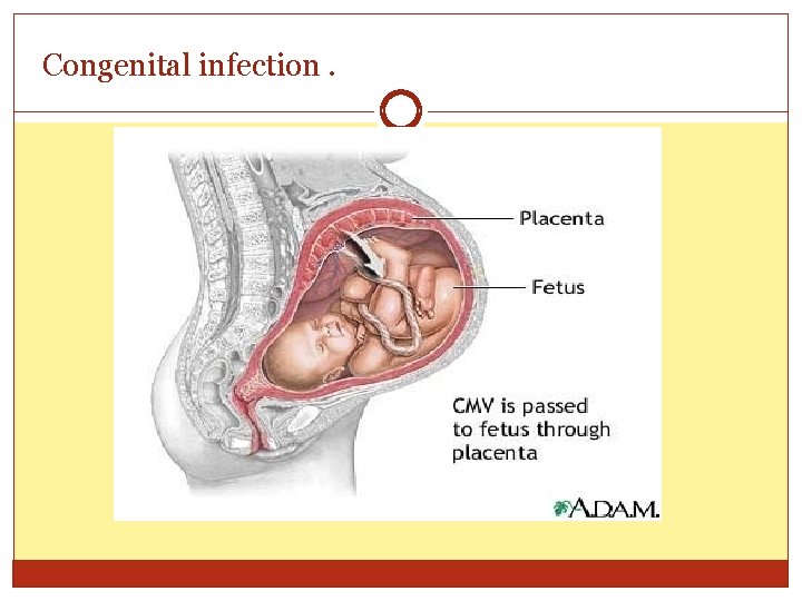 Congenital infection. 