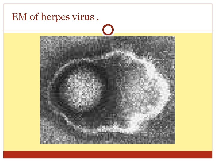 EM of herpes virus. 