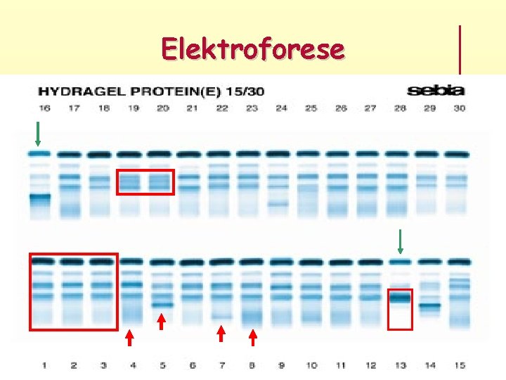 Elektroforese Elektroforese