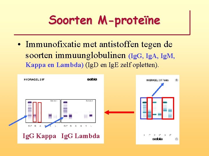 Soorten M-proteïne • Immunofixatie met antistoffen tegen de soorten immuunglobulinen (Ig. G, Ig. A, Soorten M-proteïne • Immunofixatie met antistoffen tegen de soorten immuunglobulinen (Ig. G, Ig. A,