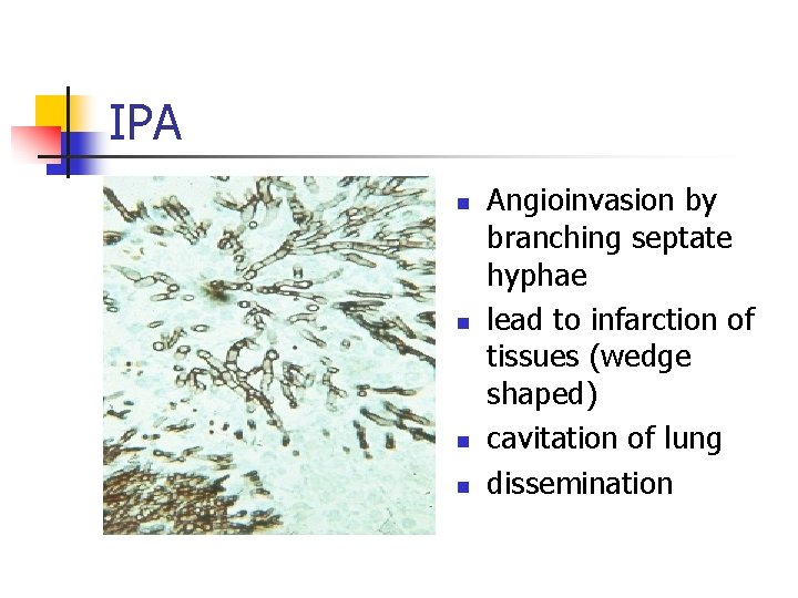 IPA n n Angioinvasion by branching septate hyphae lead to infarction of tissues (wedge