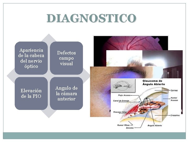 DIAGNOSTICO Apariencia de la cabeza del nervio óptico Defectos campo visual Elevación de la