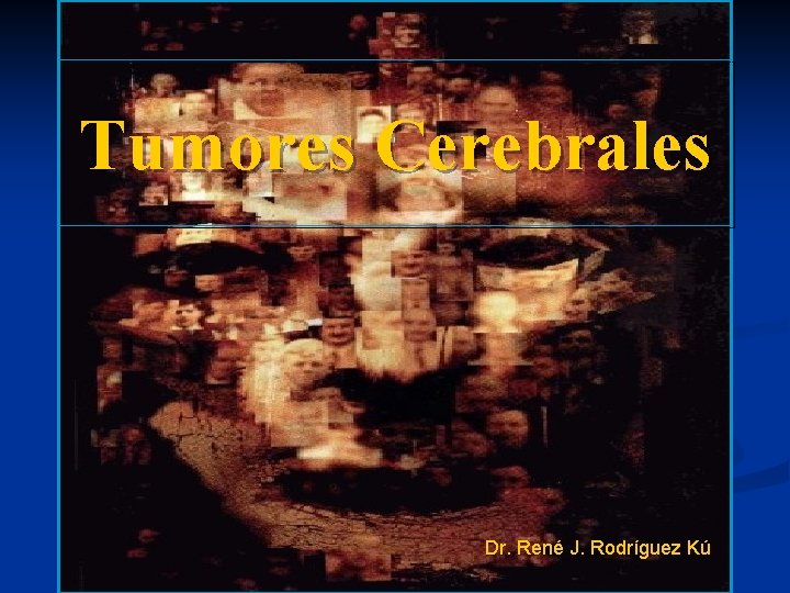 Tumores Cerebrales Dr. René J. Rodríguez Kú 