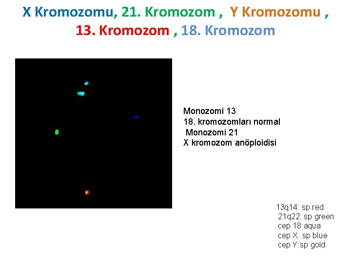 X Kromozomu, 21. Kromozom , Y Kromozomu , 13. Kromozom , 18. Kromozom Monozomi