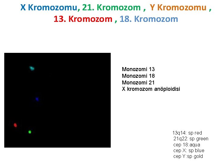 X Kromozomu, 21. Kromozom , Y Kromozomu , 13. Kromozom , 18. Kromozom Monozomi