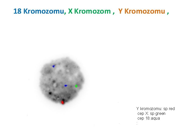 18 Kromozomu, X Kromozom , Y Kromozomu , Y kromozomu: sp red cep X: