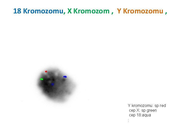 18 Kromozomu, X Kromozom , Y Kromozomu , Y kromozomu: sp red cep X: