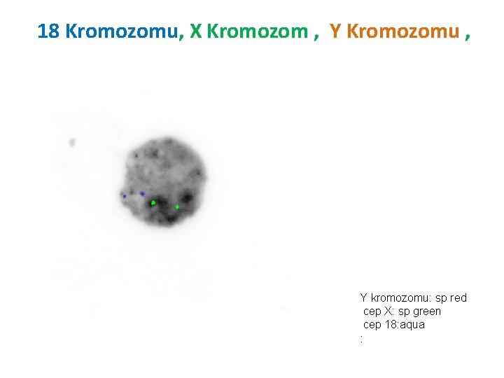 18 Kromozomu, X Kromozom , Y Kromozomu , Y kromozomu: sp red cep X: