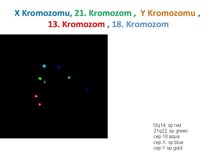 X Kromozomu, 21. Kromozom , Y Kromozomu , 13. Kromozom , 18. Kromozom 13