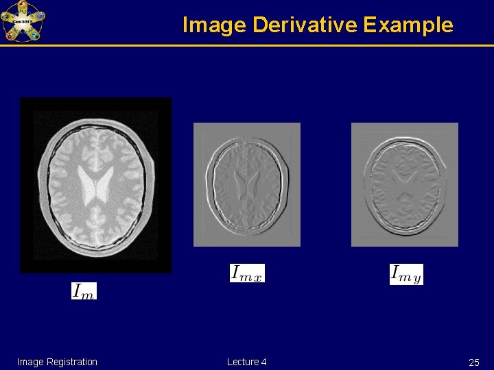 Image Derivative Example Image Registration Lecture 4 25 