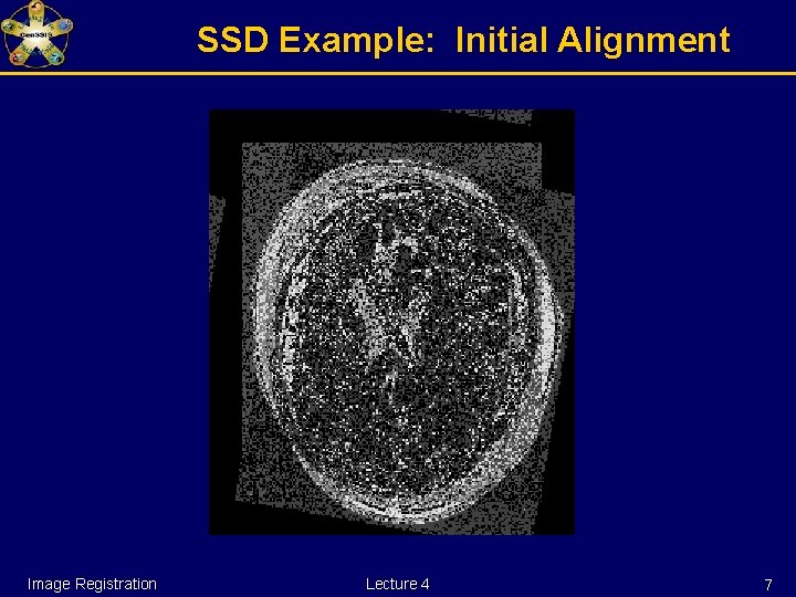 SSD Example: Initial Alignment Image Registration Lecture 4 7 