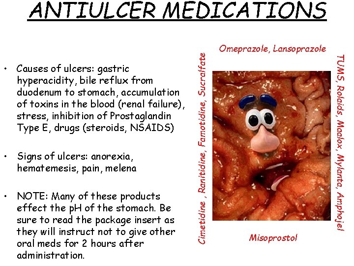  • Signs of ulcers: anorexia, hematemesis, pain, melena • NOTE: Many of these