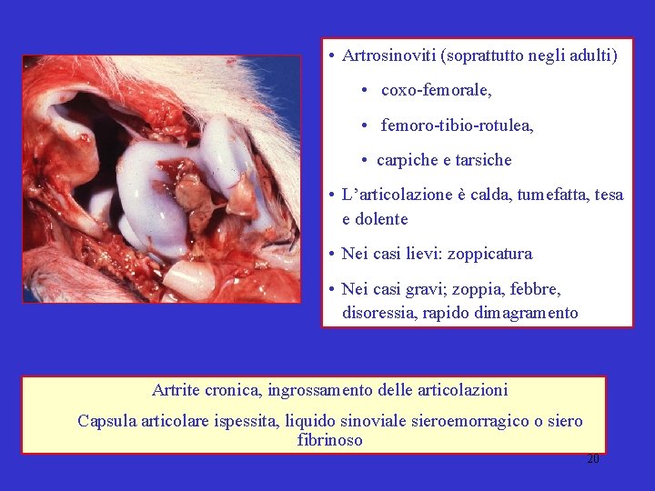  • Artrosinoviti (soprattutto negli adulti) • coxo-femorale, • femoro-tibio-rotulea, • carpiche e tarsiche