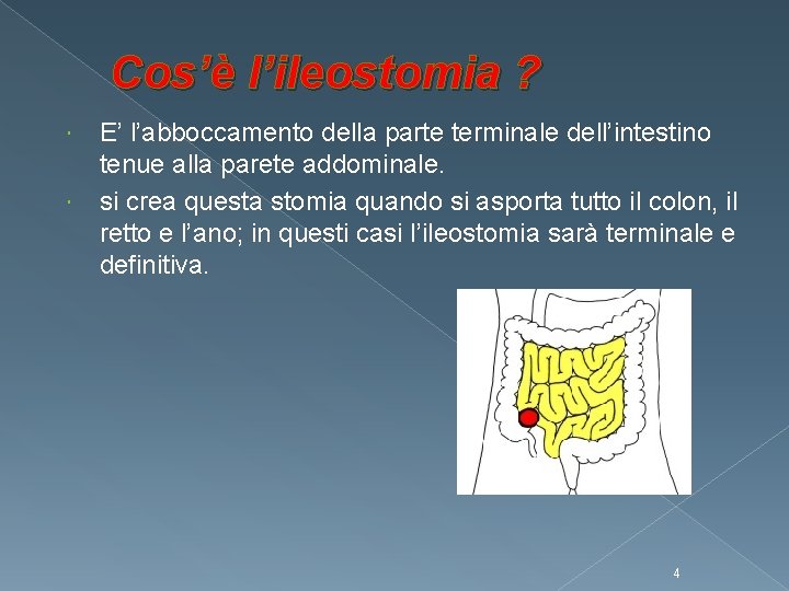 Cos’è l’ileostomia ? E’ l’abboccamento della parte terminale dell’intestino tenue alla parete addominale. si