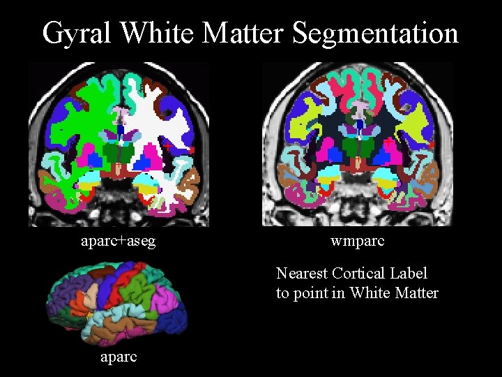 Gyral White Matter Segmentation + aparc+aseg + wmparc Nearest Cortical Label to point in
