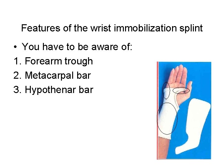 Features of the wrist immobilization splint • You have to be aware of: 1.