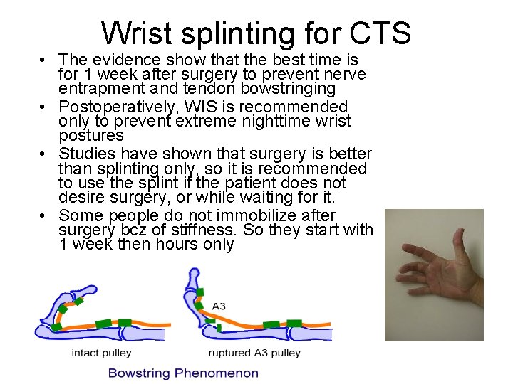 Wrist splinting for CTS • The evidence show that the best time is for