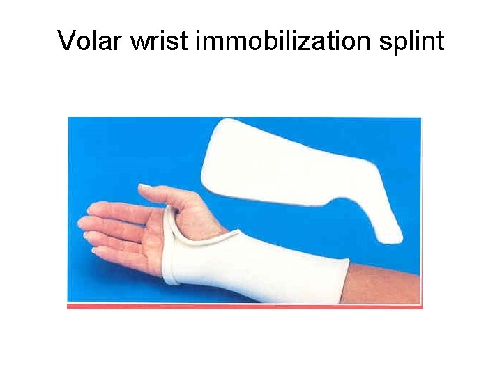 Volar wrist immobilization splint 