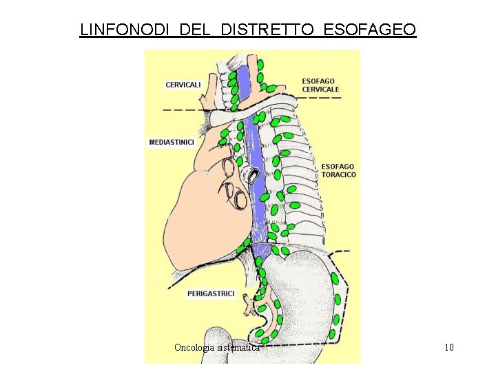 LINFONODI DEL DISTRETTO ESOFAGEO Oncologia sistematica 10 
