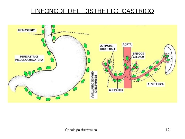 LINFONODI DEL DISTRETTO GASTRICO Oncologia sistematica 12 