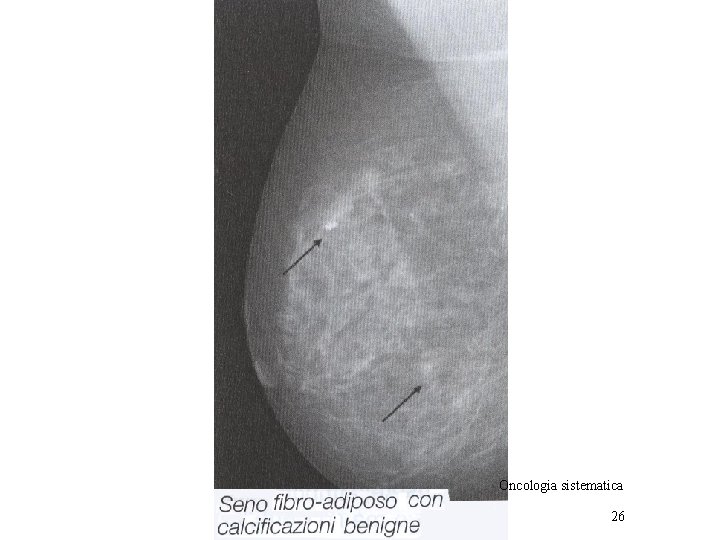 Oncologia sistematica 26 