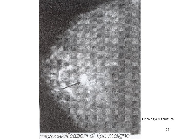 Oncologia sistematica 27 