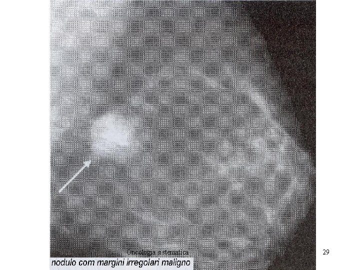 Oncologia sistematica 29 