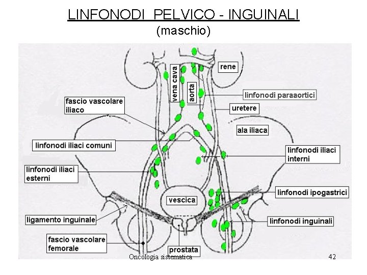 LINFONODI PELVICO - INGUINALI (maschio) Oncologia sistematica 42 