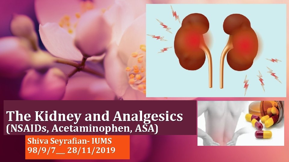 The Kidney and Analgesics (NSAIDs, Acetaminophen, ASA) Shiva Seyrafian- IUMS 98/9/7___ 28/11/2019 