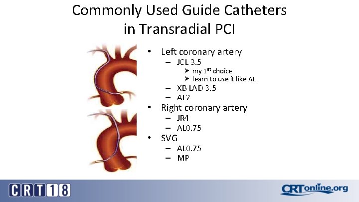 Commonly Used Guide Catheters in Transradial PCI • Left coronary artery – JCL 3.